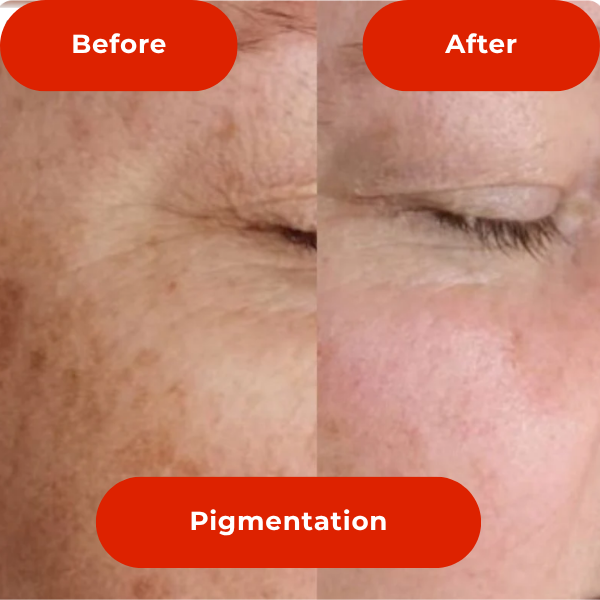 LED Light Therapy Face Mask-The #1 Trusted For Skin Rejuvenation