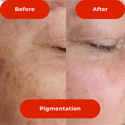 LED Light Therapy Face Mask-The #1 Trusted For Skin Rejuvenation