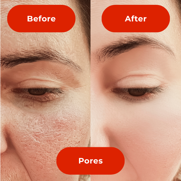 LED Light Therapy Face Mask-The #1 Trusted For Skin Rejuvenation