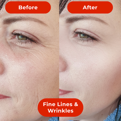 LED Light Therapy Face Mask-The #1 Trusted For Skin Rejuvenation